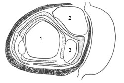 A compound bud with primary, secondary, and tertiary buds