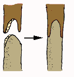 saddle graft